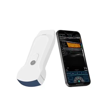 3 viename daugiafunkcis belaidis ultragarsinis zondas spalvotas dopleris