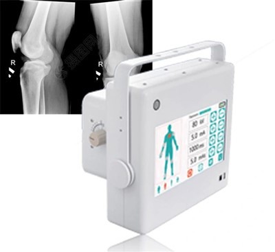 FTLF 10 1 kW nešiojamasis „Xray“ aparatas